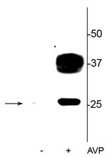 Phospho-Aquaporin 2 (Ser269) Antibody in Western Blot (WB)