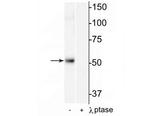 Phospho-HDAC2 (Ser394) Antibody in Western Blot (WB)