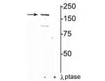 Phospho-NMDAR2A (Tyr1325) Antibody in Western Blot (WB)