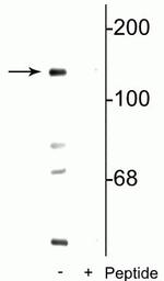 Phospho-NMDAR2C (Ser1096) Antibody in Western Blot (WB)