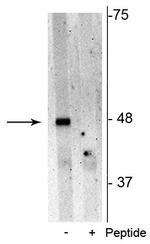 Phospho-SQSTM1 (Ser28) Antibody in Western Blot (WB)