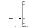 Phospho-Cardiac Troponin I (Ser23, Ser24) Antibody in Western Blot (WB)