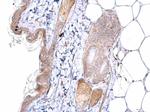 ATOH7 Antibody in Immunohistochemistry (Paraffin) (IHC (P))