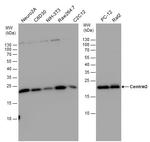 Centrin 3 Antibody in Western Blot (WB)