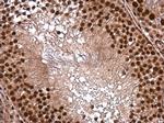 DNTTIP1 Antibody in Immunohistochemistry (Paraffin) (IHC (P))