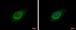 LARP1 Antibody in Immunocytochemistry (ICC/IF)