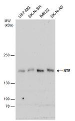 NTE Antibody in Western Blot (WB)