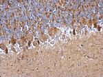 PDDC1 Antibody in Immunohistochemistry (Paraffin) (IHC (P))