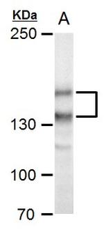 SPAG5 Antibody in Western Blot (WB)