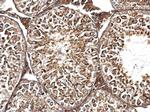 TMF1 Antibody in Immunohistochemistry (Paraffin) (IHC (P))