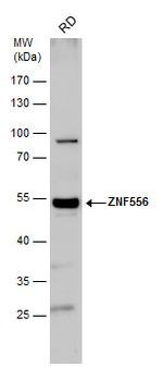 ZNF556 Antibody in Western Blot (WB)