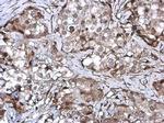 ZNF599 Antibody in Immunohistochemistry (Paraffin) (IHC (P))