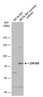 ZNF599 Antibody in Western Blot (WB)