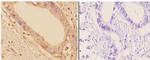 ADD1/ADD2 Antibody in Immunohistochemistry (Paraffin) (IHC (P))