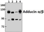 ADD1/ADD2 Antibody in Western Blot (WB)