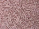 ADD1/ADD2 Antibody in Immunohistochemistry (Paraffin) (IHC (P))