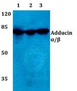 ADD1/ADD2 Antibody in Western Blot (WB)