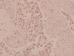 AMPK alpha-1,2 Antibody in Immunohistochemistry (Paraffin) (IHC (P))