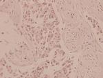 AMPK alpha-1,2 Antibody in Immunohistochemistry (Paraffin) (IHC (P))