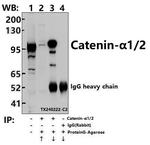 alpha Catenin Antibody in Immunoprecipitation (IP)