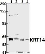 Cytokeratin 14/16 Antibody in Western Blot (WB)