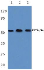 Cytokeratin 14/16 Antibody in Western Blot (WB)