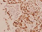 Cyclin L1 Antibody in Immunohistochemistry (Paraffin) (IHC (P))