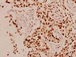 Cyclin L1 Antibody in Immunohistochemistry (Paraffin) (IHC (P))