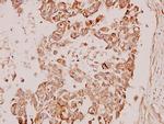 PDPK1 Antibody in Immunohistochemistry (Paraffin) (IHC (P))