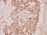 PDPK1 Antibody in Immunohistochemistry (Paraffin) (IHC (P))