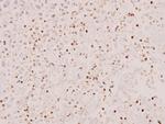 STAT5 alpha/beta Antibody in Immunohistochemistry (Paraffin) (IHC (P))