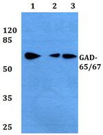 GAD65/GAD67 Antibody in Western Blot (WB)