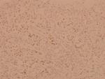 FOXO1/FOXO3/FOXO4 Antibody in Immunohistochemistry (Paraffin) (IHC (P))