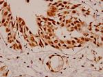 SF1 Antibody in Immunohistochemistry (Paraffin) (IHC (P))