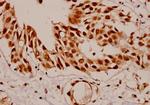 SF1 Antibody in Immunohistochemistry (Paraffin) (IHC (P))