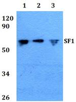 SF1 Antibody in Western Blot (WB)