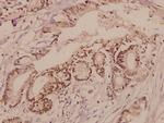 TGFBR2 Antibody in Immunohistochemistry (Paraffin) (IHC (P))