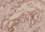 TGFBR2 Antibody in Immunohistochemistry (Paraffin) (IHC (P))