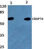 MED26 Antibody in Western Blot (WB)