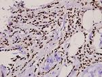 TBX15/TBX18 Antibody in Immunohistochemistry (Paraffin) (IHC (P))