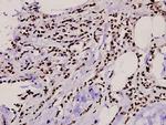 TBX15/TBX18 Antibody in Immunohistochemistry (Paraffin) (IHC (P))