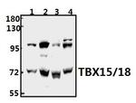 TBX15/TBX18 Antibody in Western Blot (WB)