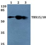 TBX15/TBX18 Antibody in Western Blot (WB)