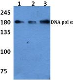 POLA1 Antibody in Western Blot (WB)