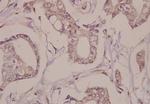 Fra1 Antibody in Immunohistochemistry (Paraffin) (IHC (P))