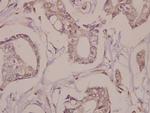 Fra1 Antibody in Immunohistochemistry (Paraffin) (IHC (P))