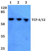 TCF4/TCF12 Antibody in Western Blot (WB)