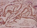 CDK11B Antibody in Immunohistochemistry (Paraffin) (IHC (P))