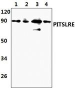 CDK11B Antibody in Western Blot (WB)