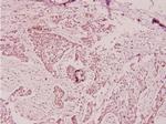 PTX3 Antibody in Immunohistochemistry (Paraffin) (IHC (P))